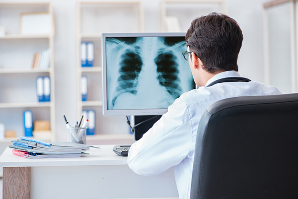 Lung Cancer Screening