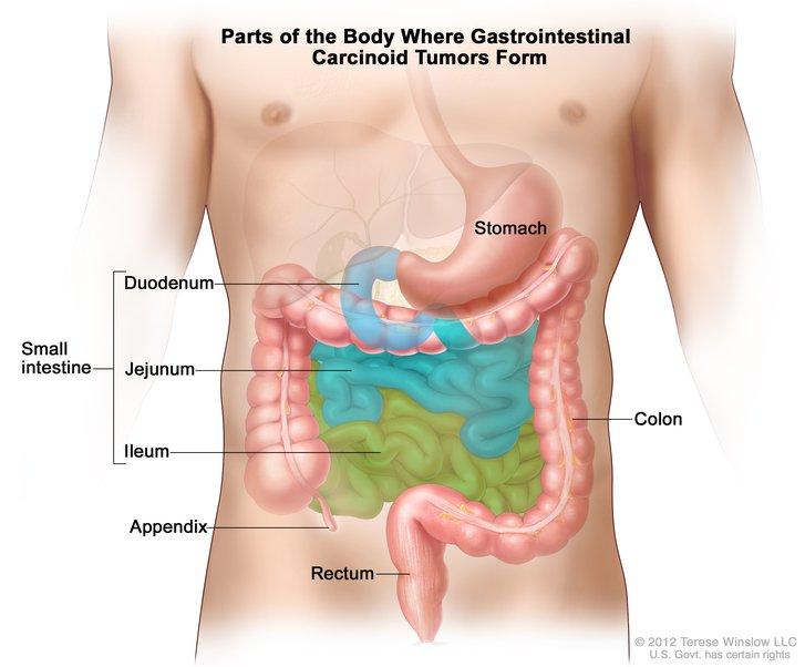 GI Tumors