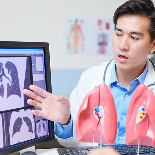 Catching Lung Cancer Early Could Save Your Life